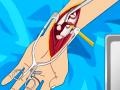 Laro Arm surgery 2