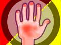 Laro Hands Attack