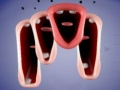 Laro Crazy Lips