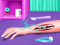 Laro Fracture Emergency Surgery