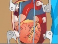Laro Heart Surgery