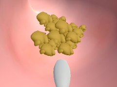 Laro Earwax Clinic