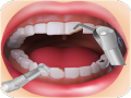 Dentist games 